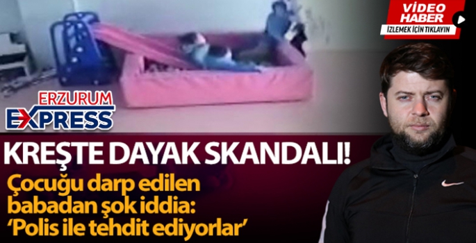 5 yaşındaki çocuk eğitim gördüğü kreşte öğretmeni tarafından darp edildi