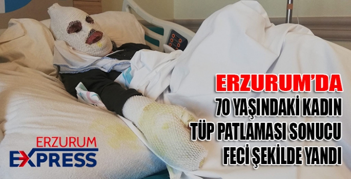 70 yaşındaki kadın tüp patlaması sonucu feci şekilde yandı