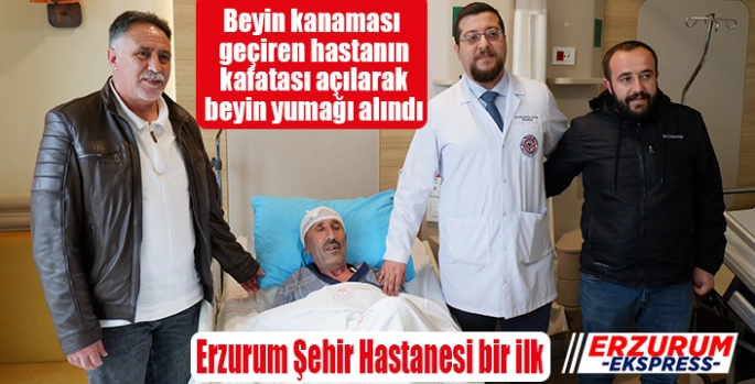 Beyin kanaması geçiren hastanın kafatası açılarak beyin yumağı alındı