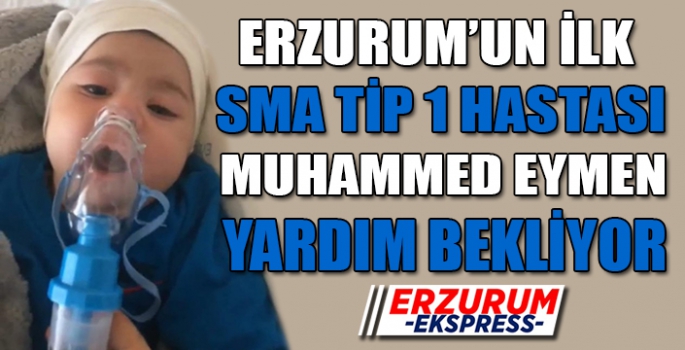 ERZURUM'UN İLK SMA TİP 1 HASTASI MUHAMMED EYMEN YARDIM BEKLİYOR