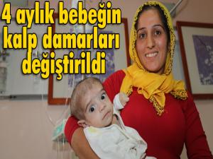 4 aylık bebeğin kalp damarları değiştirildi