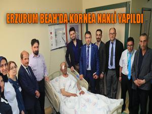 Erzurum BEAH'ta kornea nakli yapıldı 