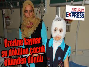 Isıtıcıdaki kaynar su üzerine dökülen çocuk ölümden döndü