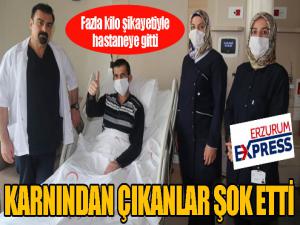 Karnından çıkanlar şoke etti...