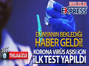 Korona virüs aşısı için ilk test yapıldı