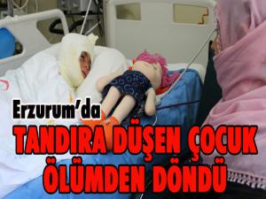 Tandıra düşen çocuk ölümden döndü 