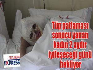 Tüp patlaması sonucu yanan kadın 2 aydır iyileşeceği günü bekliyor