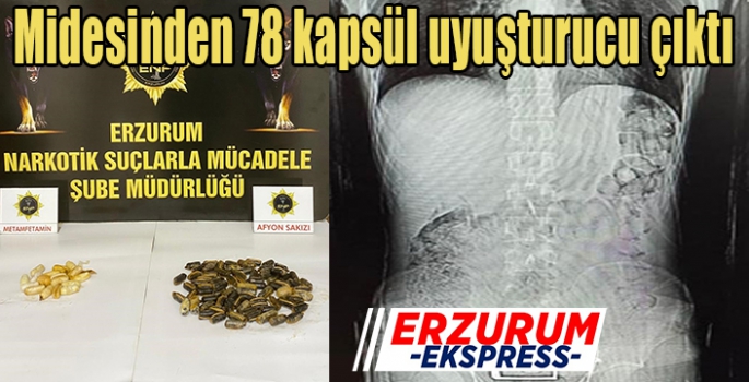 Midesinden 78 kapsül uyuşturucu çıktı