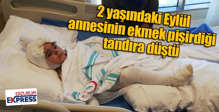 2 yaşındaki Eylül annesinin ekmek pişirdiği tandıra düştü